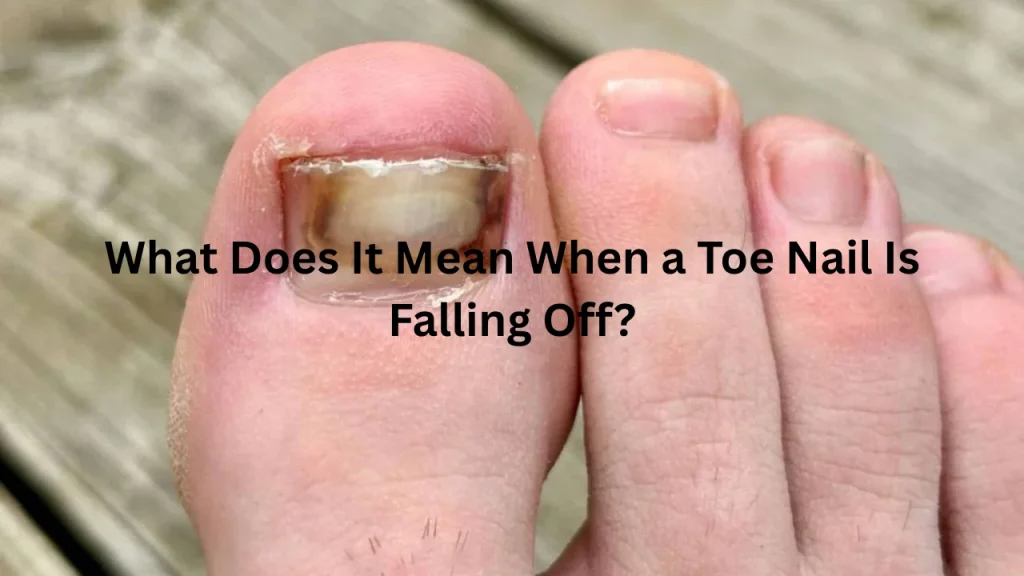 What Does It Mean When a Toe Nail Is Falling Off