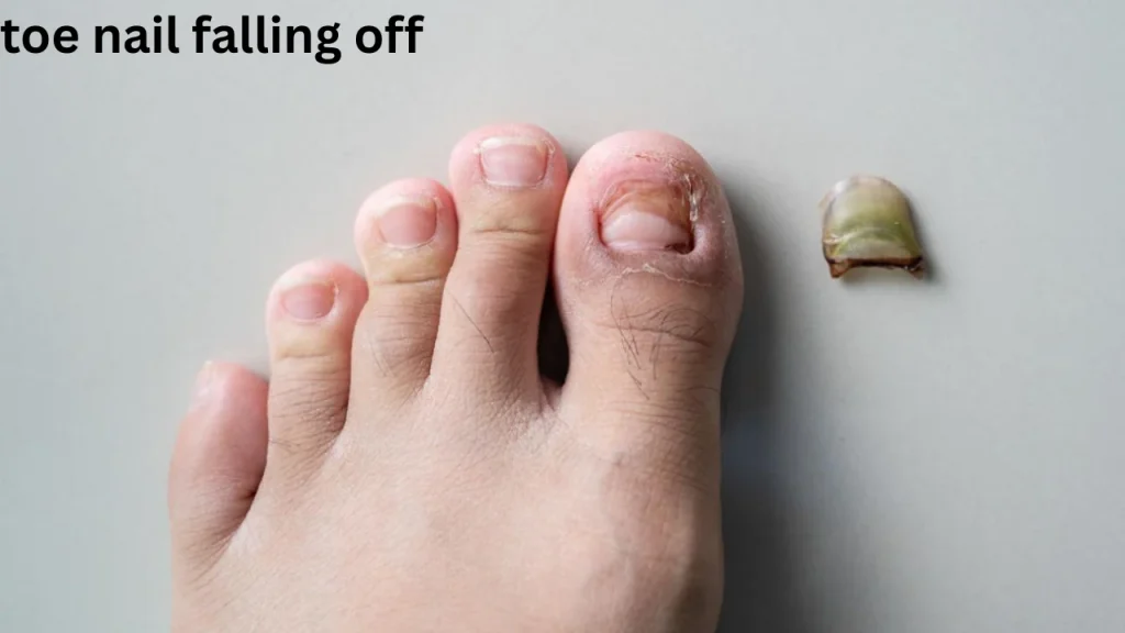 toe nail falling off